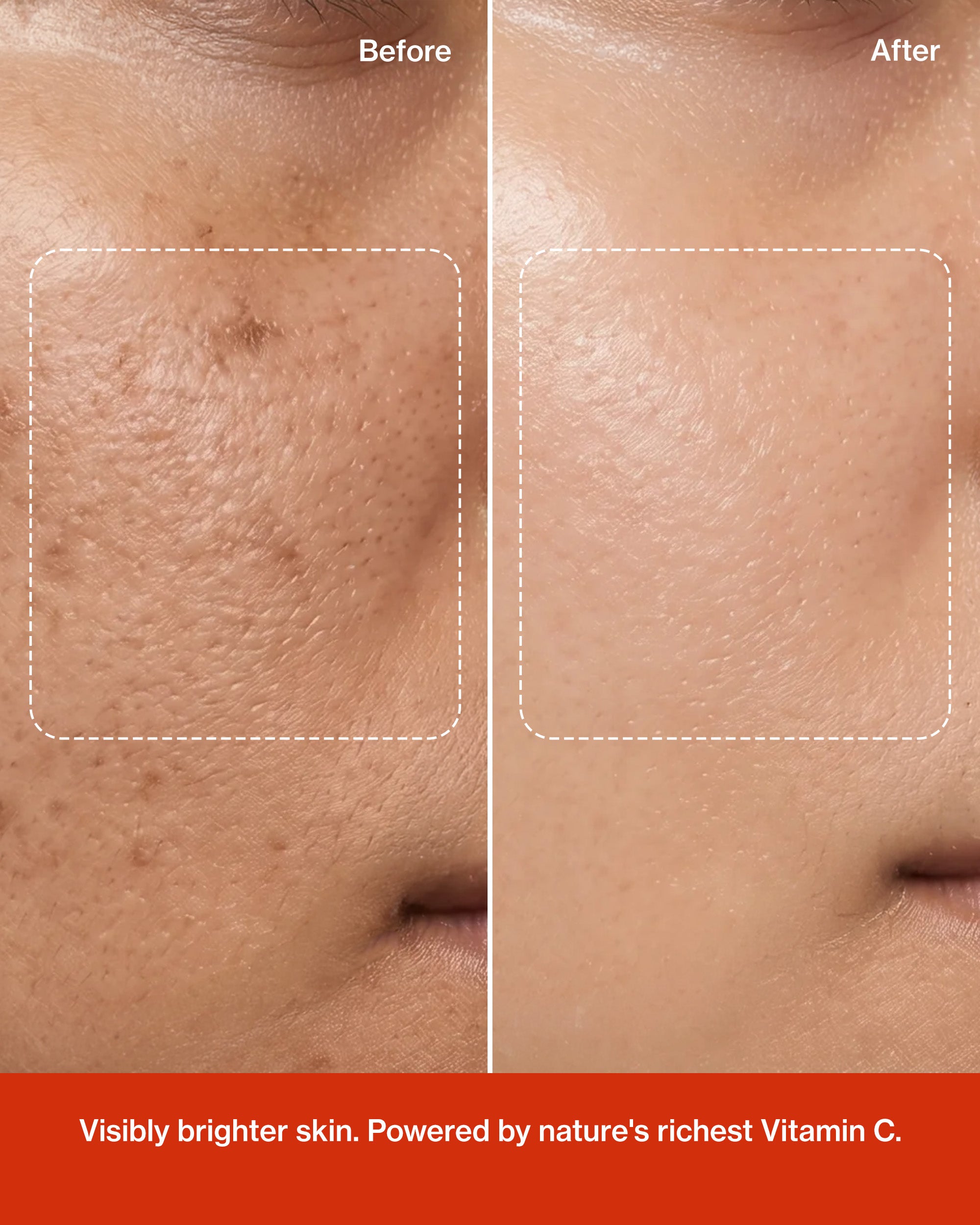 Glow Vitamin C Skin Brightening Serum