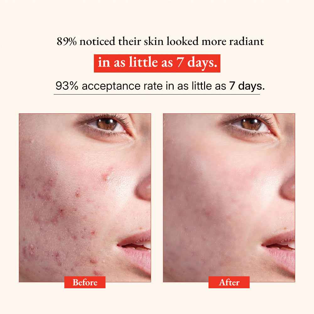 Glow Vitamin C Skin Brightening Serum 1
